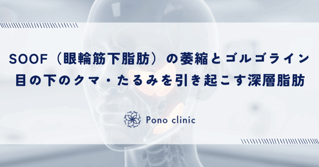 SOOF（眼輪筋下脂肪）の萎縮とゴルゴライン｜目の下のクマ・たるみを引き起こす深層脂肪