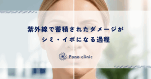 紫外線によるDNA損傷と修復能力の限界｜蓄積されたダメージがシミ・イボになる過程