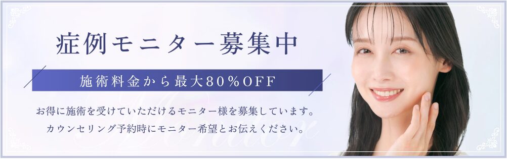 モニター募集中（施術料金から最大80%OFF）のバナー