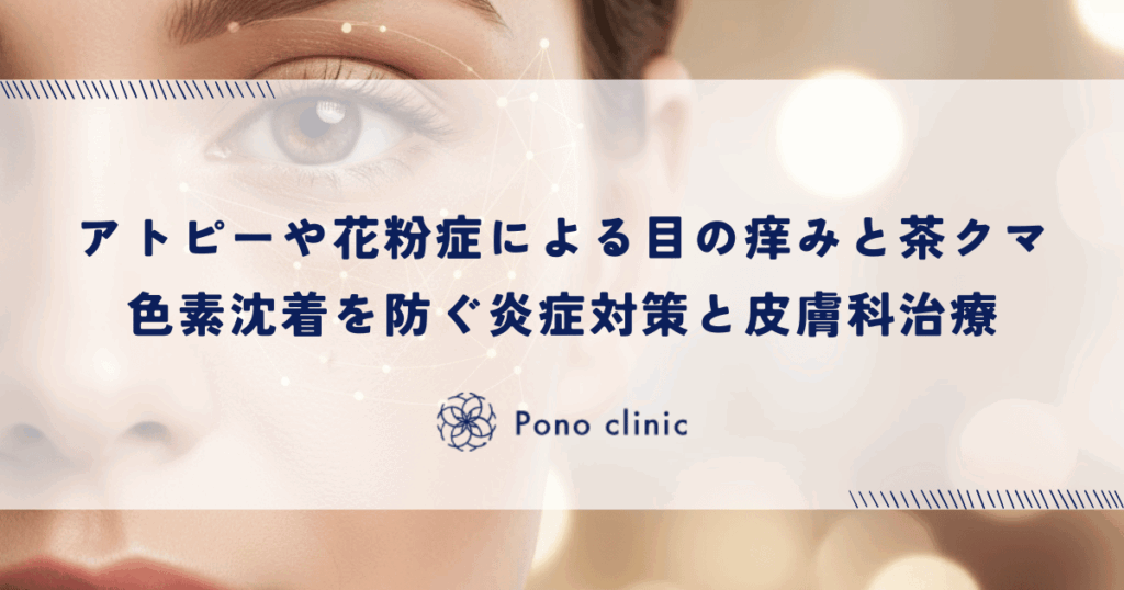 アトピーや花粉症による目の痒みと茶クマ｜色素沈着を防ぐ炎症対策と皮膚科治療