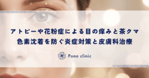 アトピーや花粉症による目の痒みと茶クマ｜色素沈着を防ぐ炎症対策と皮膚科治療